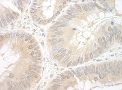 EAF2 Antibody, Novus Biologicals 0.1mL; Unlabeled:Antibodies, Polyclonal